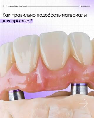 Идеальный протез — таблица материалов для вашего комфорта.